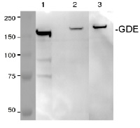 GDE / AGL | Glycogen debranching enzyme  in the group Antibodies Human Cell Biology / Other proteins at Agrisera AB (Antibodies for research) (AS09 454)